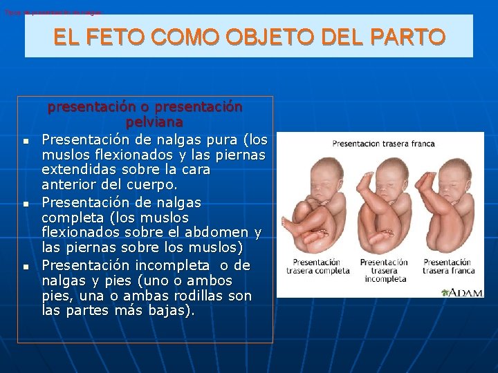 Tipos de presentación de nalgas: EL FETO COMO OBJETO DEL PARTO n n n