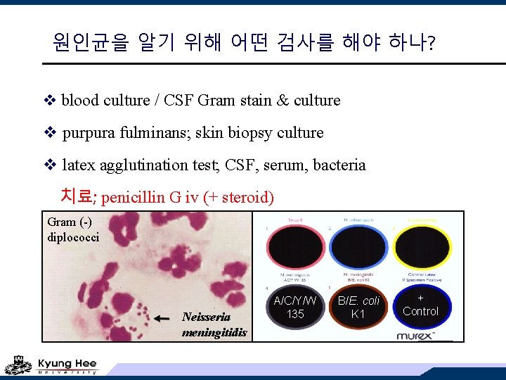 원인균을 알기 위해 어떤 검사를 해야 하나? v blood culture / CSF Gram stain