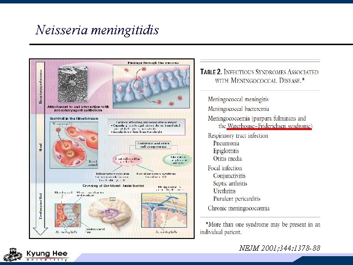 Neisseria meningitidis NEJM 2001; 344: 1378 -88 