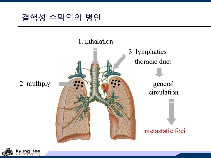 결핵성 수막염의 병인 1. inhalation 3. lymphatics thoracic duct 2. multiply general circulation metastatic