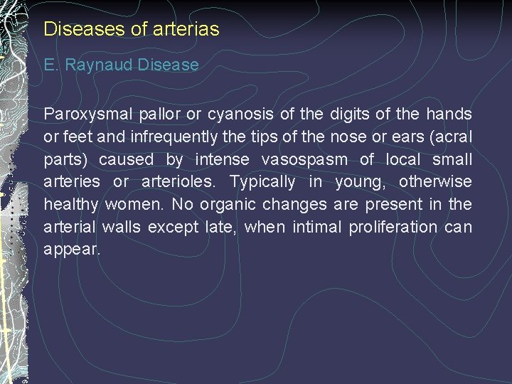 Diseases of arterias E. Raynaud Disease Paroxysmal pallor or cyanosis of the digits of