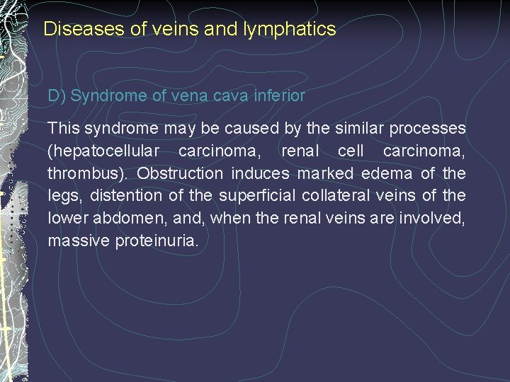 Diseases of veins and lymphatics D) Syndrome of vena cava inferior This syndrome may