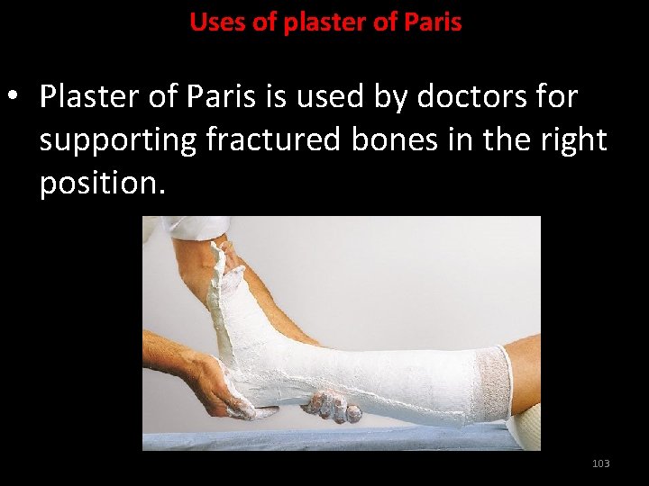 Uses of plaster of Paris • Plaster of Paris is used by doctors for