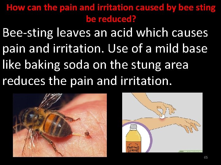 How can the pain and irritation caused by bee sting be reduced? Bee-sting leaves