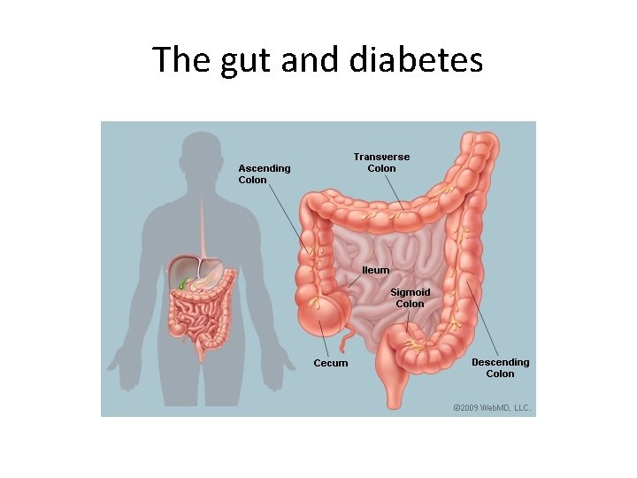 The gut and diabetes 