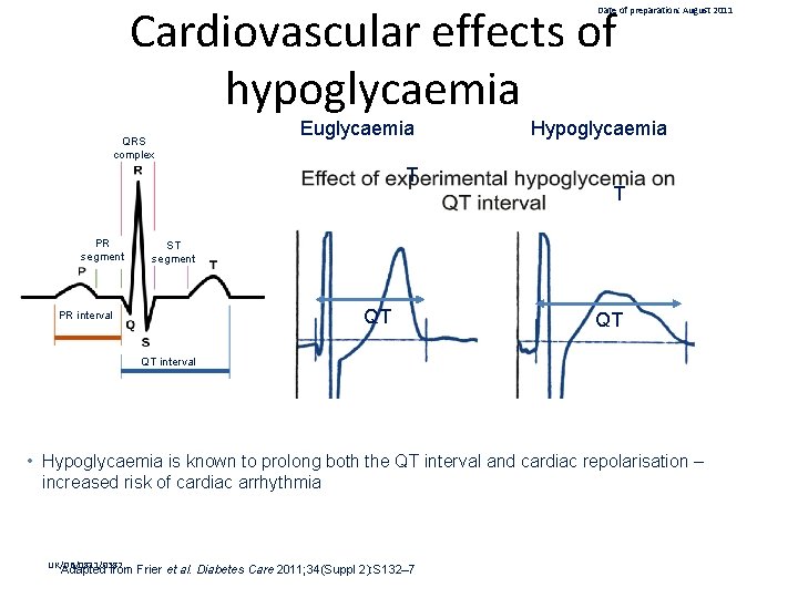 Cardiovascular effects of hypoglycaemia Date of preparation: August 2011 QRS complex Euglycaemia T PR