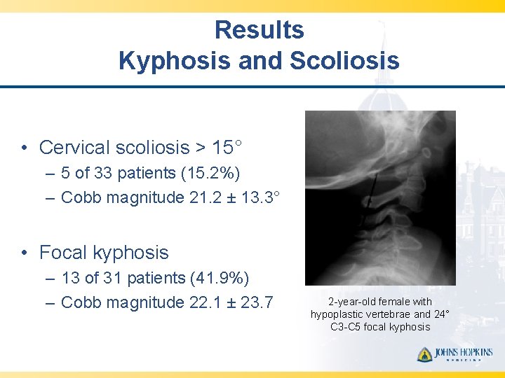 Results Kyphosis and Scoliosis • Cervical scoliosis > 15° – 5 of 33 patients