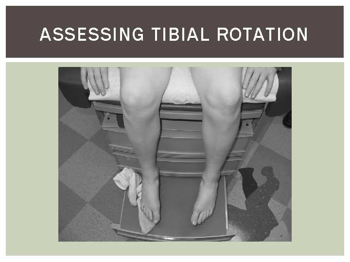 ASSESSING TIBIAL ROTATION 