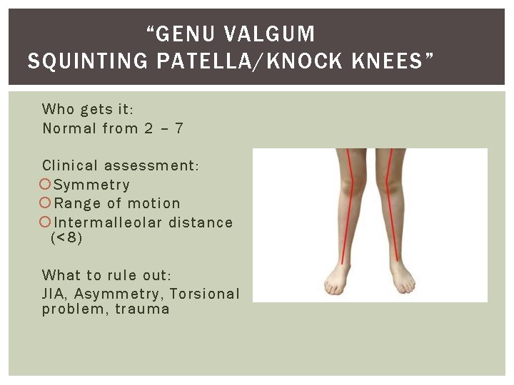 “GENU VALGUM SQUINTING PATELLA/KNOCK KNEES” Who gets it: Normal from 2 – 7 Clinical