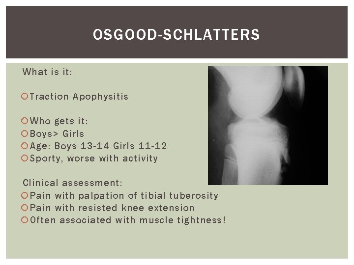 OSGOOD-SCHLATTERS What is it: Traction Apophysitis Who gets it: Boys> Girls Age: Boys 13