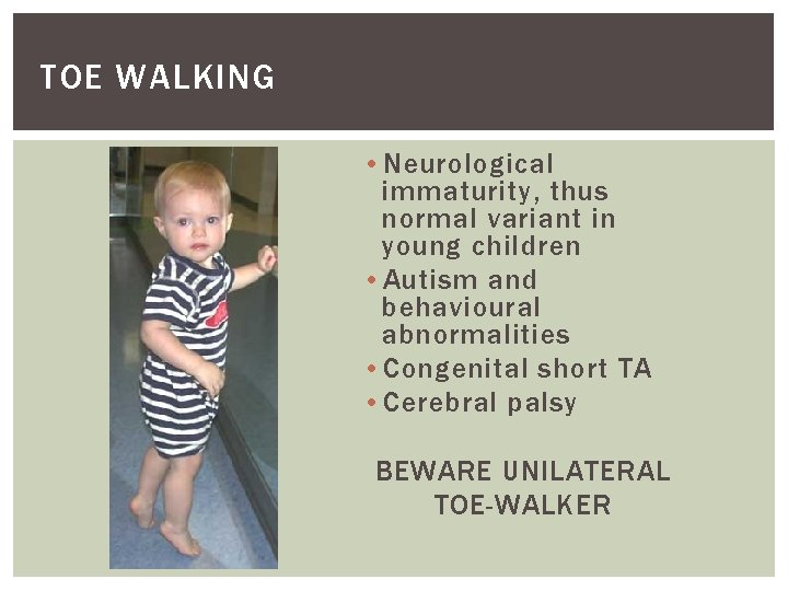 TOE WALKING • Neurological immaturity, thus normal variant in young children • Autism and