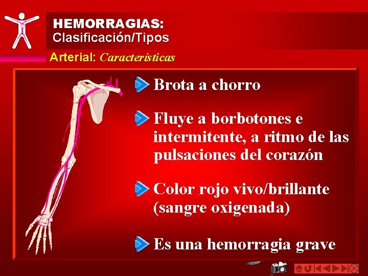 HEMORRAGIAS: Clasificación/Tipos Arterial: Características Brota a chorro Fluye a borbotones e intermitente, a ritmo