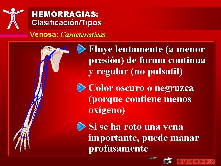 HEMORRAGIAS: Clasificación/Tipos Venosa: Características Fluye lentamente (a menor presión) de forma continua y regular