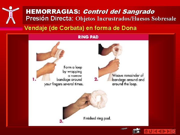 HEMORRAGIAS: Control del Sangrado Presión Directa: Objetos Incrustrados/Huesos Sobresale Vendaje (de Corbata) en forma