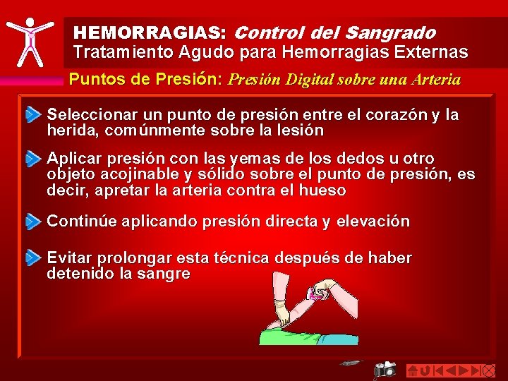 HEMORRAGIAS: Control del Sangrado Tratamiento Agudo para Hemorragias Externas Puntos de Presión: Presión Digital