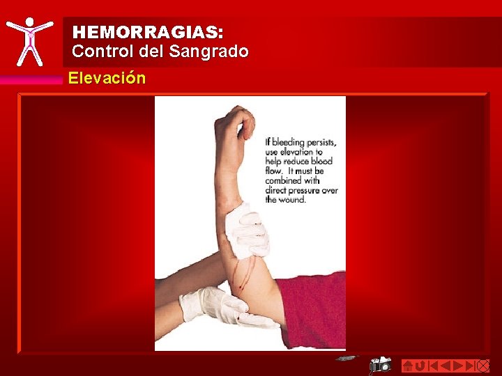 HEMORRAGIAS: Control del Sangrado Elevación 