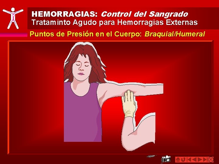 HEMORRAGIAS: Control del Sangrado Trataminto Agudo para Hemorragias Externas Puntos de Presión en el