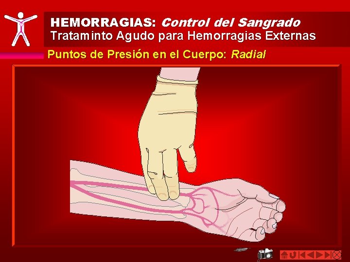 HEMORRAGIAS: Control del Sangrado Trataminto Agudo para Hemorragias Externas Puntos de Presión en el