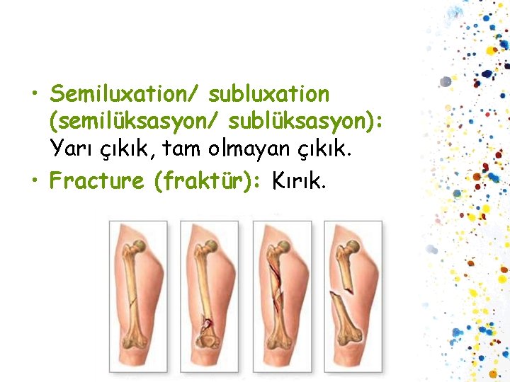  • Semiluxation/ subluxation (semilüksasyon/ sublüksasyon): Yarı çıkık, tam olmayan çıkık. • Fracture (fraktür):