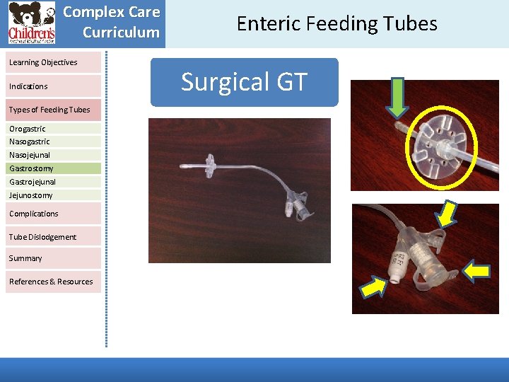 Complex Care Curriculum Learning Objectives Indications Types of Feeding Tubes Orogastric Nasojejunal Gastrostomy Gastrojejunal