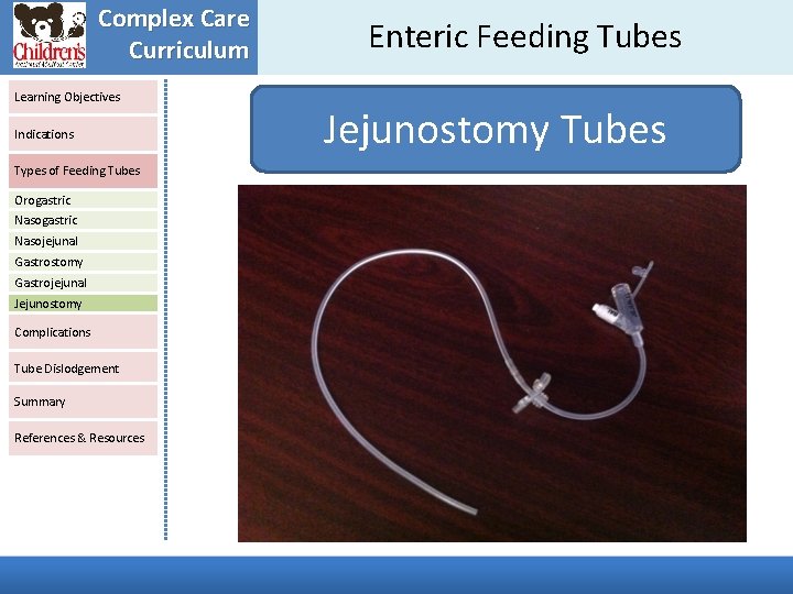 Complex Care Curriculum Learning Objectives Indications Types of Feeding Tubes Orogastric Nasojejunal Gastrostomy Gastrojejunal