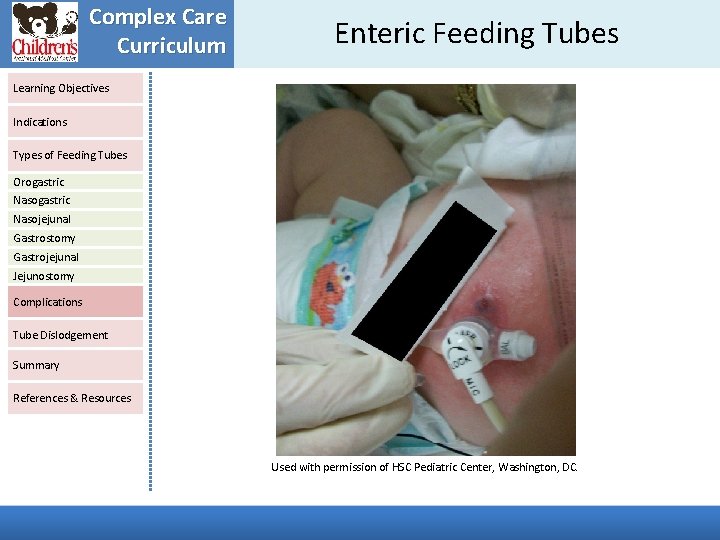 Complex Care Curriculum Enteric Feeding Tubes Learning Objectives Indications Types of Feeding Tubes Orogastric