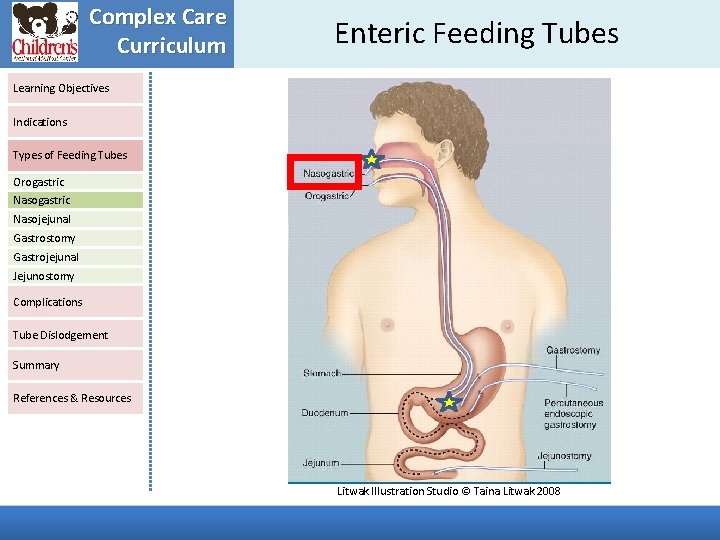 Complex Care Curriculum Enteric Feeding Tubes Learning Objectives Indications Types of Feeding Tubes Orogastric