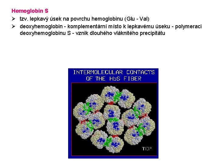 Hemoglobin S Ø tzv. lepkavý úsek na povrchu hemoglobinu (Glu - Val) Ø deoxyhemoglobin