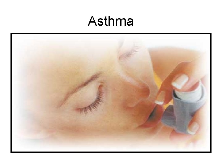 Asthma 