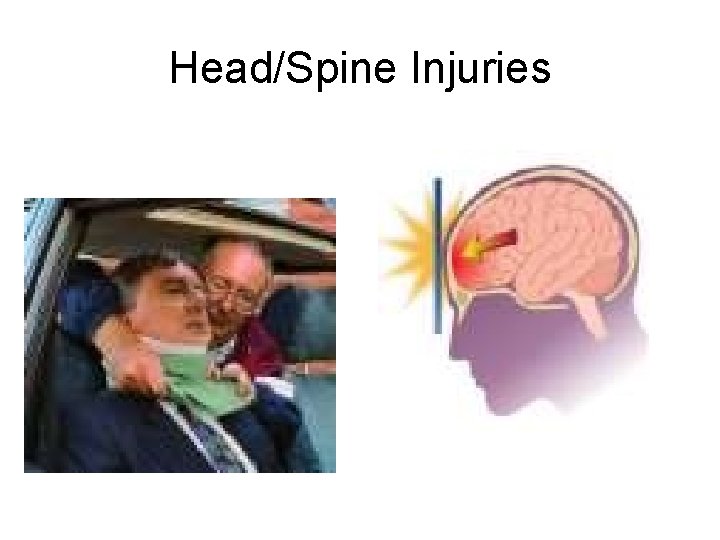 Head/Spine Injuries 