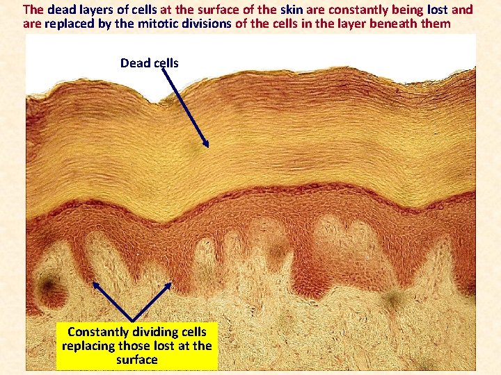 The dead layers of cells at the surface of the skin are constantly being