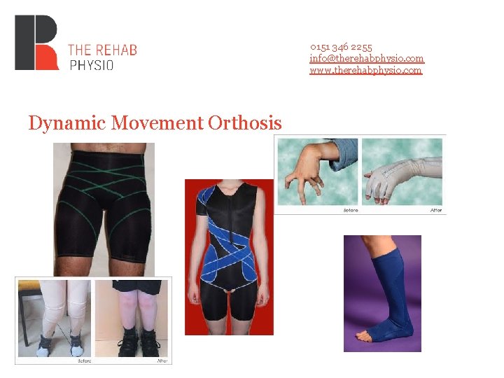 0151 346 2255 info@therehabphysio. com www. therehabphysio. com Dynamic Movement Orthosis 0151 346 2255 info@therehabphysio. com www. therehabphysio. com Dynamic Movement Orthosis