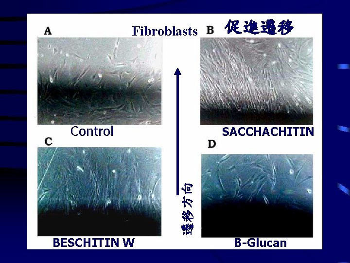 Fibroblasts Control SACCHACHITIN 遷移方向 BESCHITIN W 促進遷移 B-Glucan 