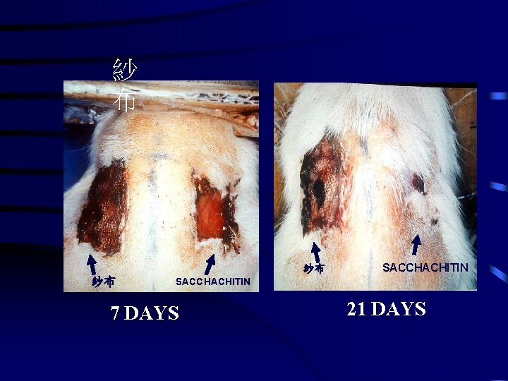 紗 布 紗布 紗布 SACCHACHITIN 7 DAYS 21 DAYS 