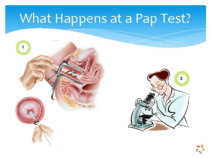 What Happens at a Pap Test? 1 2 