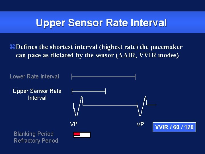 Upper Sensor Rate Interval z. Defines the shortest interval (highest rate) the pacemaker can
