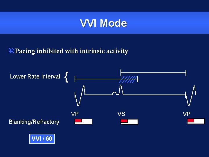 VVI Mode z. Pacing inhibited with intrinsic activity Lower Rate Interval { VP Blanking/Refractory