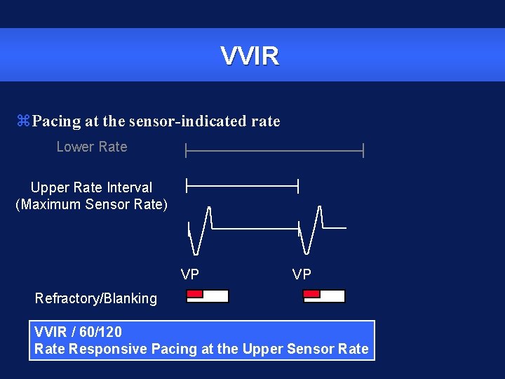 VVIR z. Pacing at the sensor-indicated rate Lower Rate Upper Rate Interval (Maximum Sensor