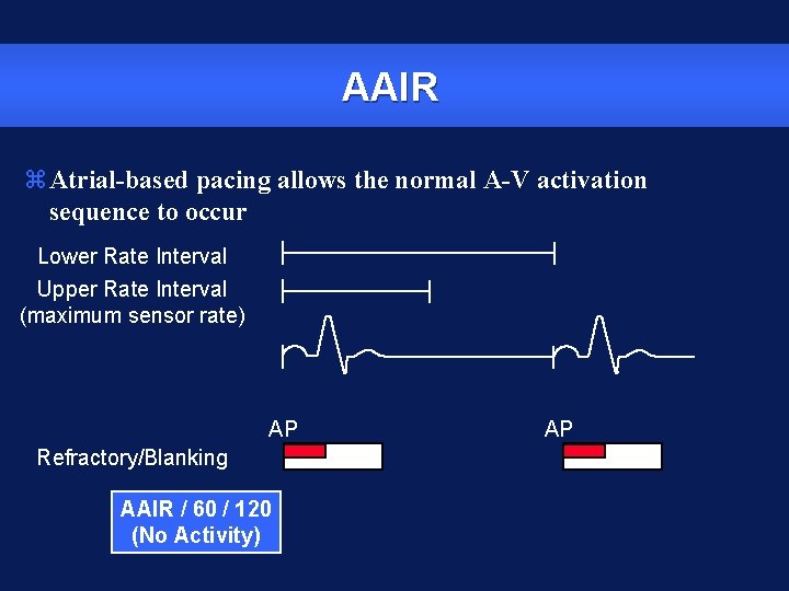 AAIR z. Atrial-based pacing allows the normal A-V activation sequence to occur Lower Rate