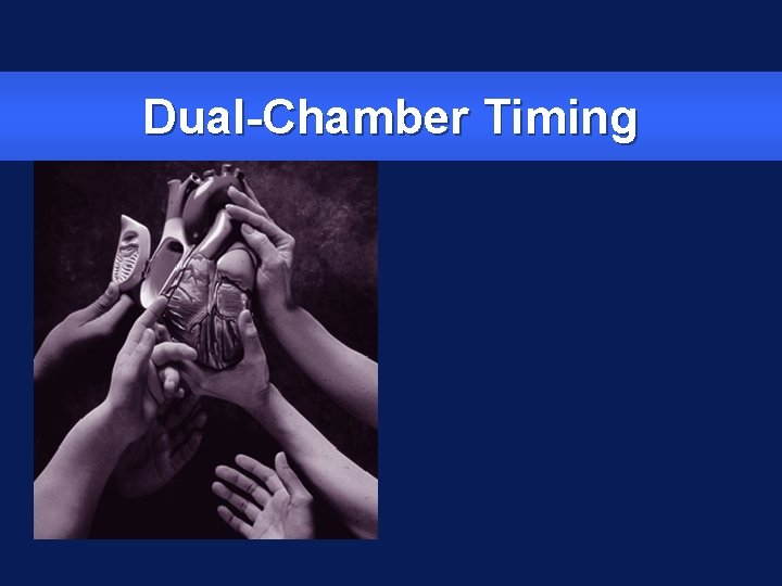 Dual-Chamber Timing 