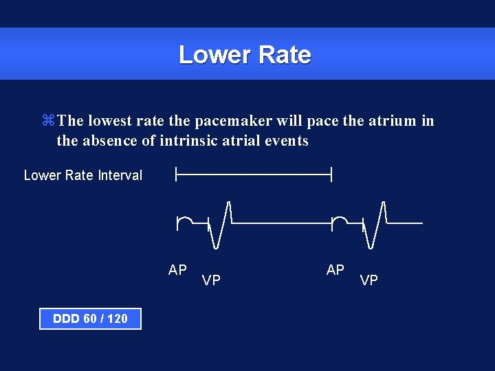 Lower Rate z. The lowest rate the pacemaker will pace the atrium in the