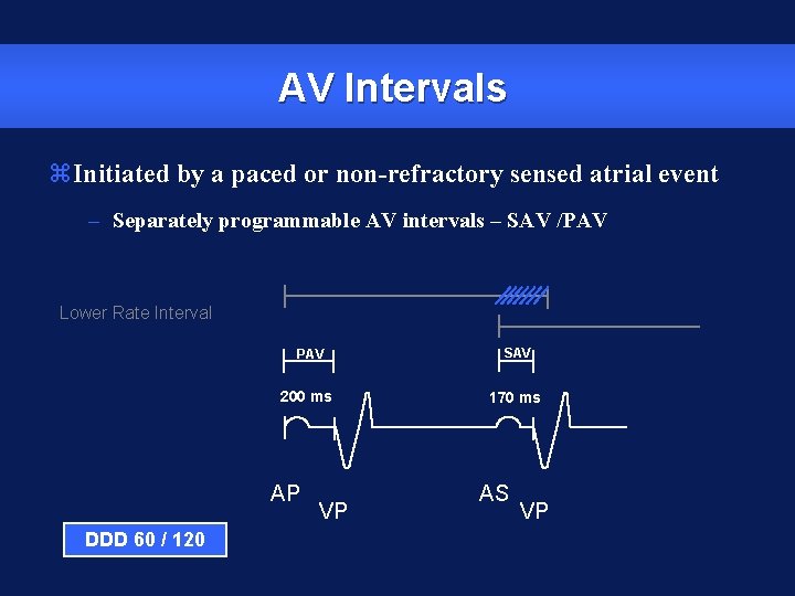 AV Intervals z. Initiated by a paced or non-refractory sensed atrial event – Separately