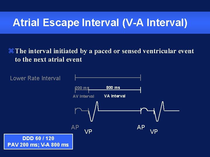 Atrial Escape Interval (V-A Interval) z. The interval initiated by a paced or sensed