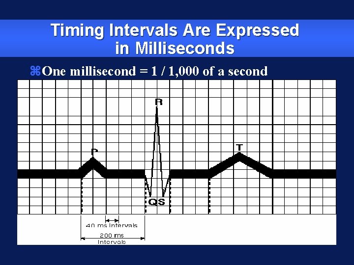 Timing Intervals Are Expressed in Milliseconds z. One millisecond = 1 / 1, 000