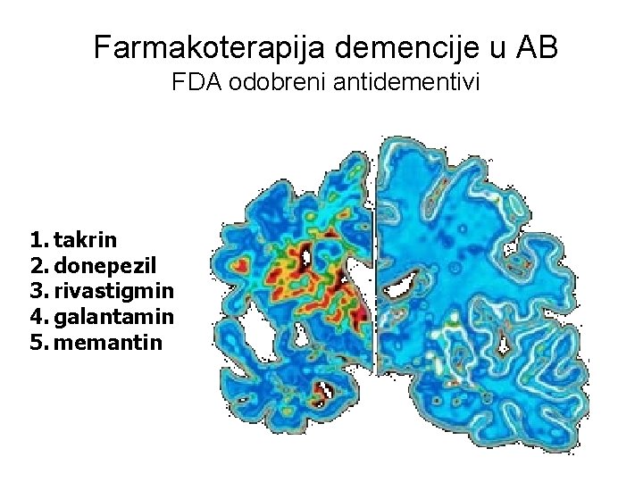 Farmakoterapija demencije u AB FDA odobreni antidementivi 1. takrin 2. donepezil 3. rivastigmin 4.