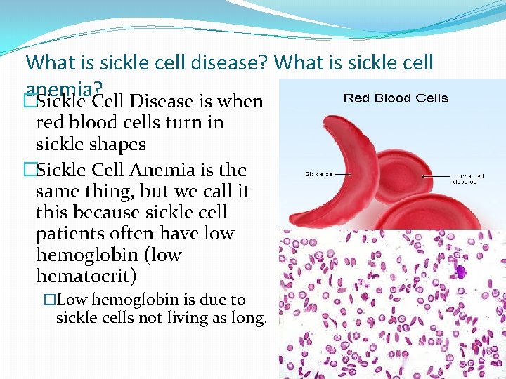 What is sickle cell disease? What is sickle cell anemia? �Sickle Cell Disease is