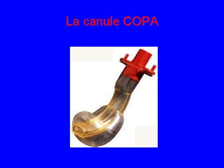 La canule COPA 