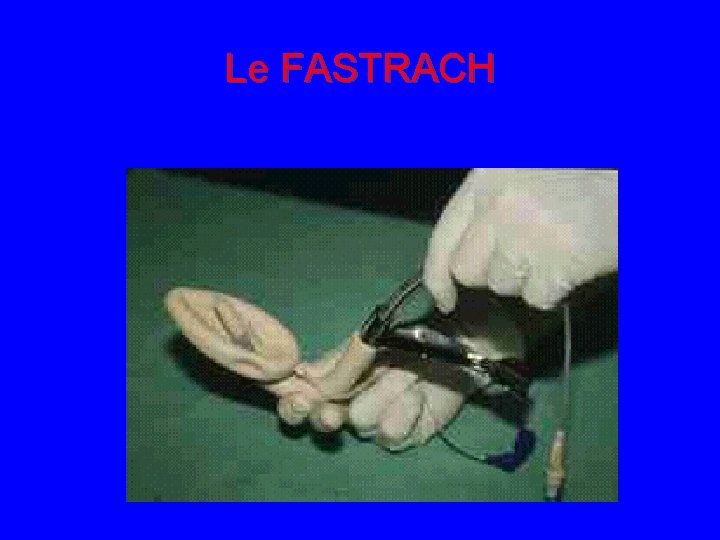 Le FASTRACH 