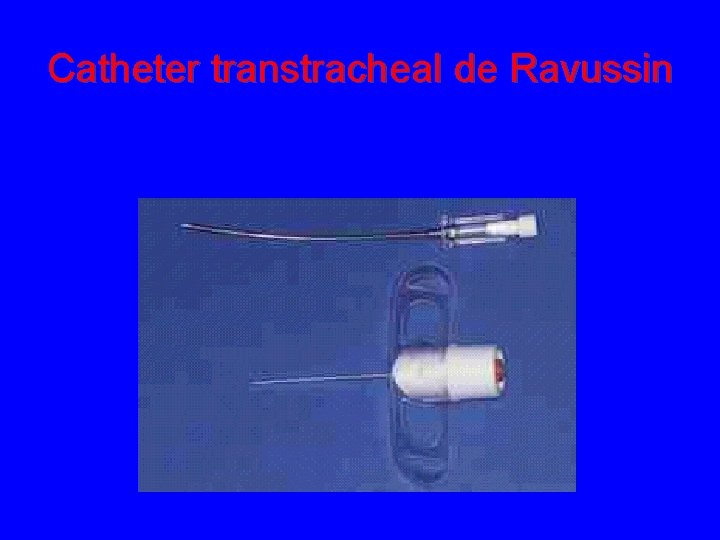 Catheter transtracheal de Ravussin 
