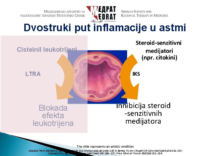 Dvostruki put inflamacije u astmi Steroid-senzitivni medijatori (npr. citokini) Cisteinil leukotrijeni LTRA Blokada efekta